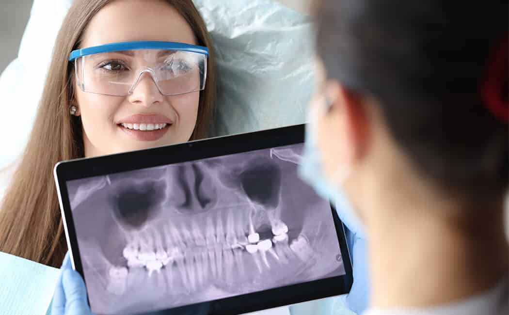 implant dentar - 3d dental
